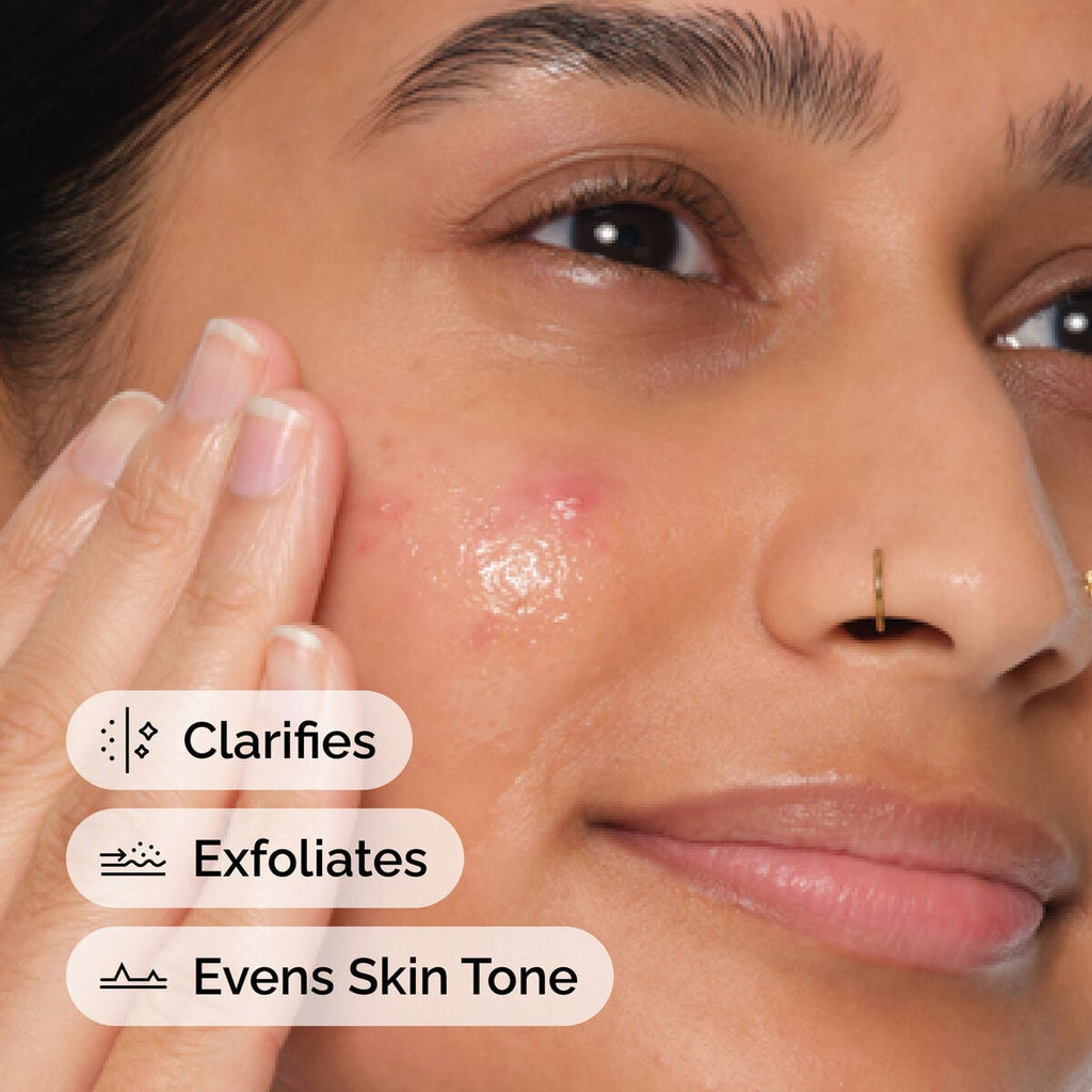 Salicylic Acid Anhydrous Solution Targeted Serum Care S2