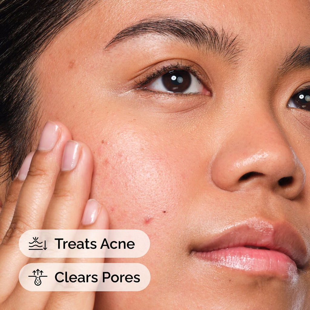 Salicylic Acid Solution Targeted Serum Care U5